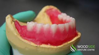 Step by Step of How Dentures Are Made [upl. by Daven105]