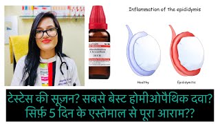 टेस्टेस की सूज़न Epididymitis Best Homeopathic Medicine Orchitis Homeopathic MedicineREPL 77 drop [upl. by Brander868]