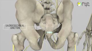 Coccyx Pain amp Ganglion Impar Block [upl. by Neville]