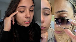 My Chalazion Experience 3x Story time  Products I use [upl. by Amada]