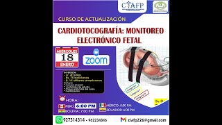 🔴𝗖𝗨𝗥𝗦𝗢 DE ACTUALIZACIÓN 👉CARDIOTOCOGRAFÍA MONITOREO ELECTRÓNICO FETAL [upl. by Tivad]