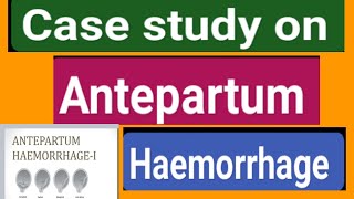 Case study on Antepartum haemorrhage videosyoutubevideosviral [upl. by Ahsi217]