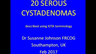 Histopathology OvarySerous cystadenoma [upl. by Ileek]