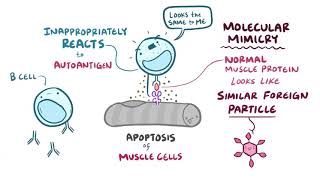 polymyositis [upl. by Garey]