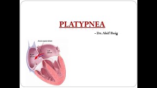 Platypnea Dr Akif Baig [upl. by Diao]