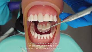 How to fix your chipped tooth at home beautifully [upl. by Ahsanat]