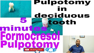 Formocresol pulpotomy on deciduous tooth 5minutes formocresol pulpotomy preclinical exercise [upl. by Margaretha]