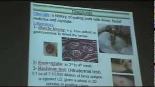 DrAzza Parasitology  Nematodes 6  Tissue Nematodes [upl. by Antons]