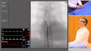 Catheterisation Left and Right Coronary Arteries [upl. by Feerahs]