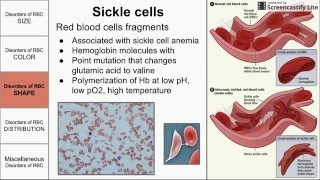 Red Blood Cell Morphological Abnormalities [upl. by Roche497]