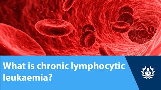 What is chronic lymphocytic leukaemia [upl. by Ingraham]