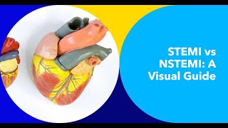 Deciphering STEMI vs NSTEMI on ECG A Comprehensive Visual Guide [upl. by Ladin]