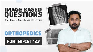 Important Images Of Orthopedics  Image Based Session for INICET by Dr Jambukeswaran [upl. by Wojak99]