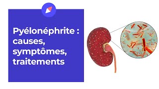 Pyélonéphrite  causes symptômes traitement [upl. by Lundeen]