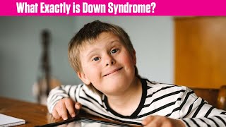 What Exactly is Down Syndrome [upl. by Aliehs]