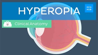 Farsightedness Hyperopia Definition causes symptoms diagnosis and treatment  Kenhub [upl. by Prober]