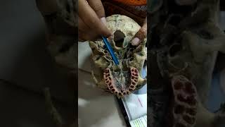 NORMA BASALIS ANTERIOR PART SKULL ANATOMY MODEL [upl. by Oiliruam]