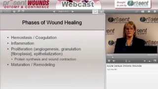 Acute versus Chronic Wounds [upl. by Endo885]