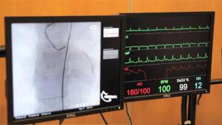 Cardiac Catheterisation Part 1  Left Coronary [upl. by Huggins]