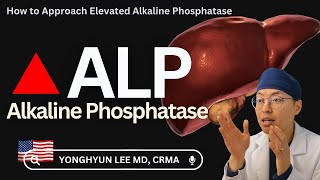 How to Approach Elevated Alkaline Phosphatase ALP [upl. by Annaik]