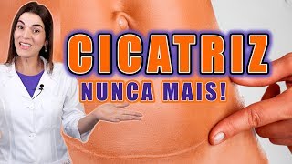 Adeus CICATRIZ no Rosto e no Corpo  Saiba como TRATAR e PREVENIR CICATRIZES [upl. by Acnalb]