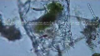 Brachionus patulus feeding Zooplankton Rotifer [upl. by Ivan]