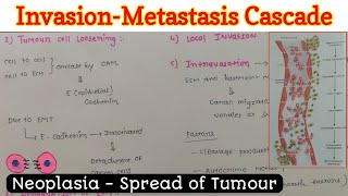 InvasionMetastasis Cascade  Spread of Tumour  Neoplasia [upl. by Arhsub]