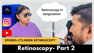 Retinoscopy Part 2  Static Retinoscopy for astigmatism  SpheroCylinder method [upl. by Nytsua]