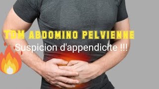 SCANNER ABDOMINOPELVIEN Appendice tuméfié avec épaississement pariétal [upl. by Dulcia]