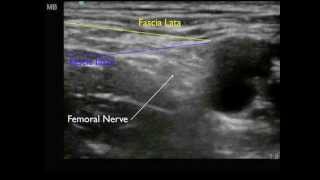 Femoral Nerve anatomy [upl. by Cattima]