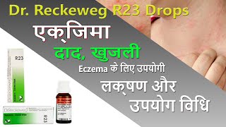 R23 Drops For Eczema  दाद खाज खुजली और चर्मरोग को दूर करने में असरदार  Medicine Media [upl. by Humble]