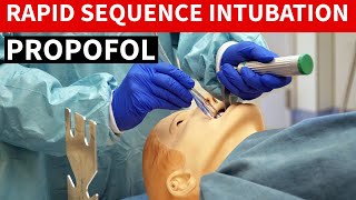 Propofol Diprivan Rapid Sequence Intubation [upl. by Irene]