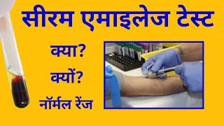 सीरम एमाइलेज टेस्ट Amylase test एमाइलेज़ की नॉर्मल रेंज amylase normal range [upl. by Adnilrev]