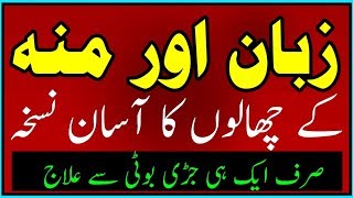 Munh ke chaly ya pakne ka asan ilaj Mouth Ulcer treatmint By Hakeem Zia Shahid [upl. by Ispep]