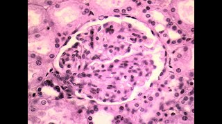 Simple squamous epithelium [upl. by Pence]