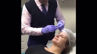 Dr Patel talks us through the Blanching technique for frown lines [upl. by Nahshun]