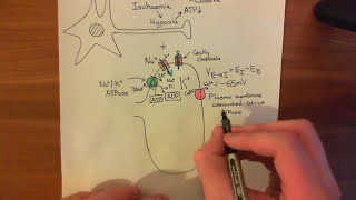 Strokes and Excitotoxicity Part 2 [upl. by Walton174]