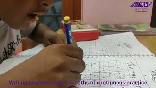 Dysgraphia  Handwriting imrovement in 3 monthsWriting strategy for chidren [upl. by Jeffy]