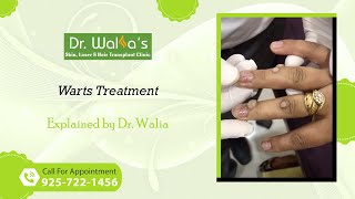 Warts Removal I Warts Treatment I How To Get Rid Of Warts [upl. by Ydnys90]