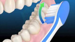 Técnica de higiene con cepillo manual [upl. by Lozar]