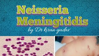 Microbiology lectureNeisseria Meningitidis  disease symptoms pathogenesisdiagnosis treatment [upl. by Vivyan877]