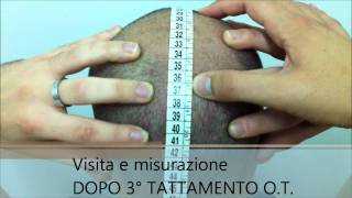 OSTEOPATIA TRICOLOGICA METODO DAMBRA TEST [upl. by Ahcilef]