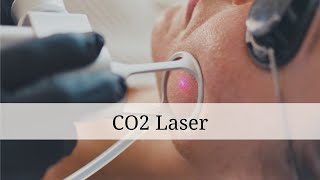 CO2 Laserbehandlung  Dr Ben Gehl [upl. by Nahsad]