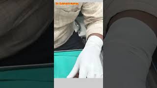 How Lignocaine Is Given Xylocaine कैसे दिया जाता है drsubhashkumar anaesthesia [upl. by Ddej600]