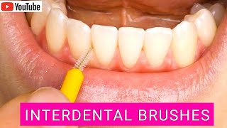 How to Use Interdental Brushes Correctly Top Tips [upl. by Colbert286]