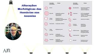 Alterações morfológicas das hemácias nas anemias [upl. by Sieber597]