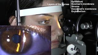 Ophthalmic Skills Series Part 15 [upl. by Anirehtak]