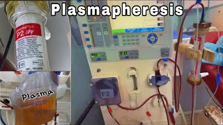 What is Plasmapheresis  Plasma Exchange  Plasmapheresis Dialysis  plasma therapy [upl. by Anahsat]