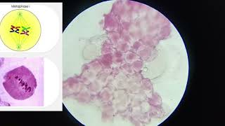 11th CLASS PRACTICAL  CELL DIVISION MEIOSIS 1 amp MEIOSIS 2  PROPHASE 5 STAGES  CBSE  GSEB bio [upl. by Marianne]