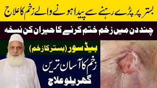 Bed Sores Prevention  Bistar Ke Zakham Ka Ilaj  Bed Sores Ka Ilaj  How To Treat bedsores [upl. by Bobseine]